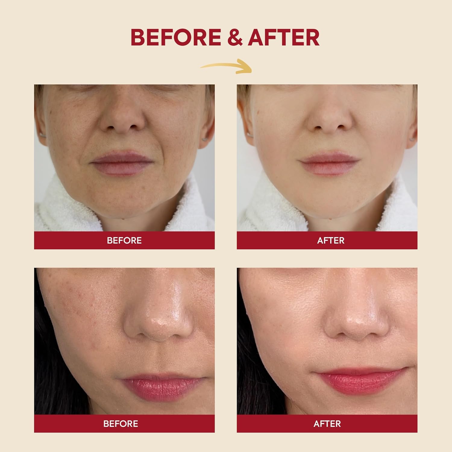 KSECRET SEOUL 1988 Essence : Snail Mucin 97% + Rice 100ml